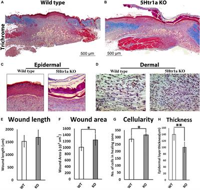 5-HT1A Receptor Function Makes Wound Healing a Happier Process